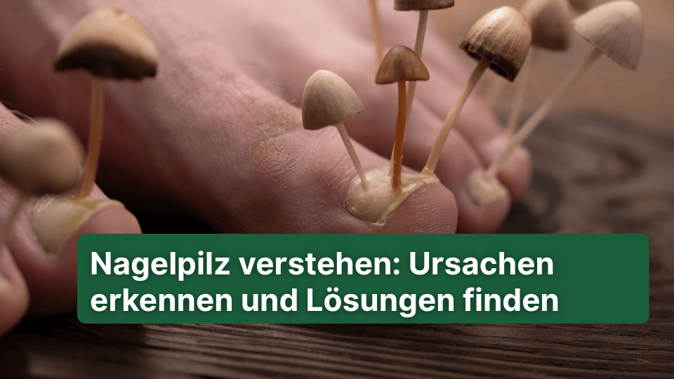Nagelpilz verstehen: Ursachen erkennen und Lösungen finden