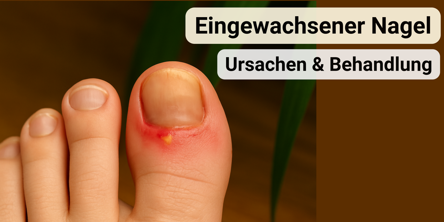 Eingewachsener Nagel: Ursachen, Symptome & effektive Hilfe