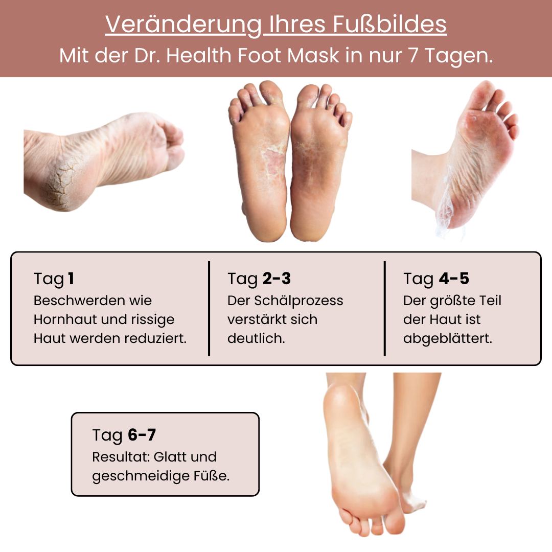 7-Tage-Anwendung der Dr. Health Foot Mask – sichtbare Veränderung von rissiger Hornhaut zu glatten, geschmeidigen Füßen durch natürlichen Peeling-Prozess